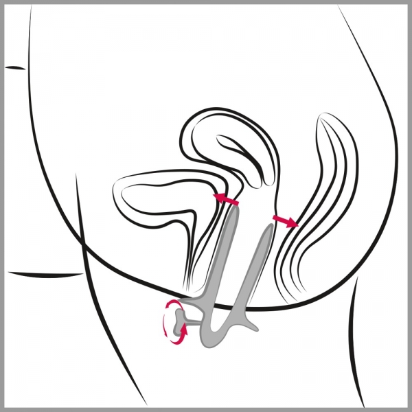 Ass View speculum 10,5 cm - Maximale opening 10cm