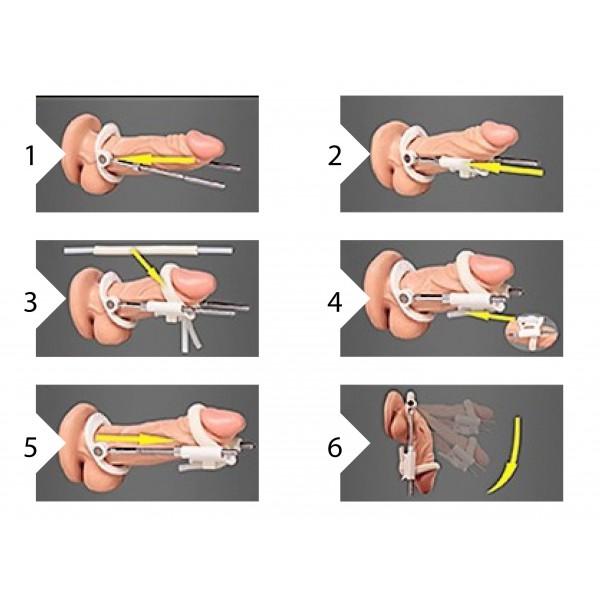 Extensor mecânico do pénis Branco